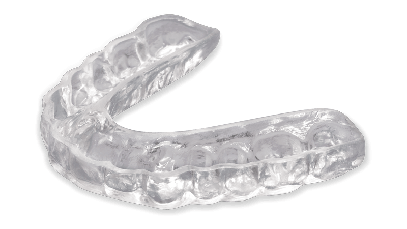 Clear custom-fitted occlusal bite splint for teeth grinding protection